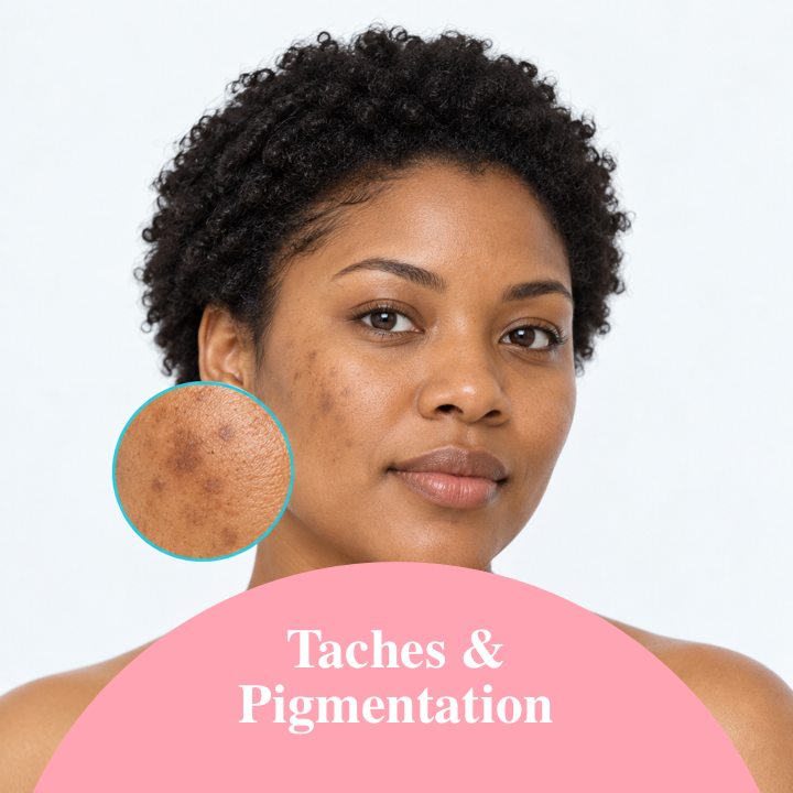 Taches & Pigmentation