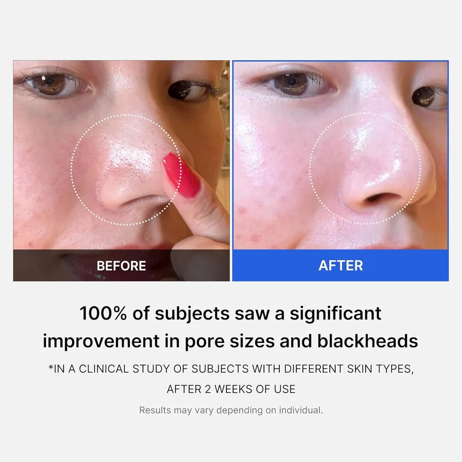 Medicube - Zero Pore Pad 2.0 - 70 pcs