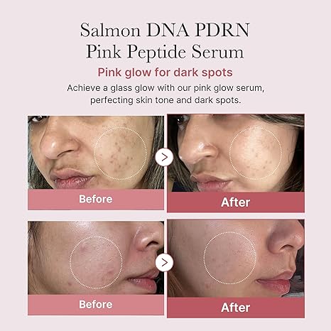 Medicube - PDRN Pink Peptide Serum - 30 ml