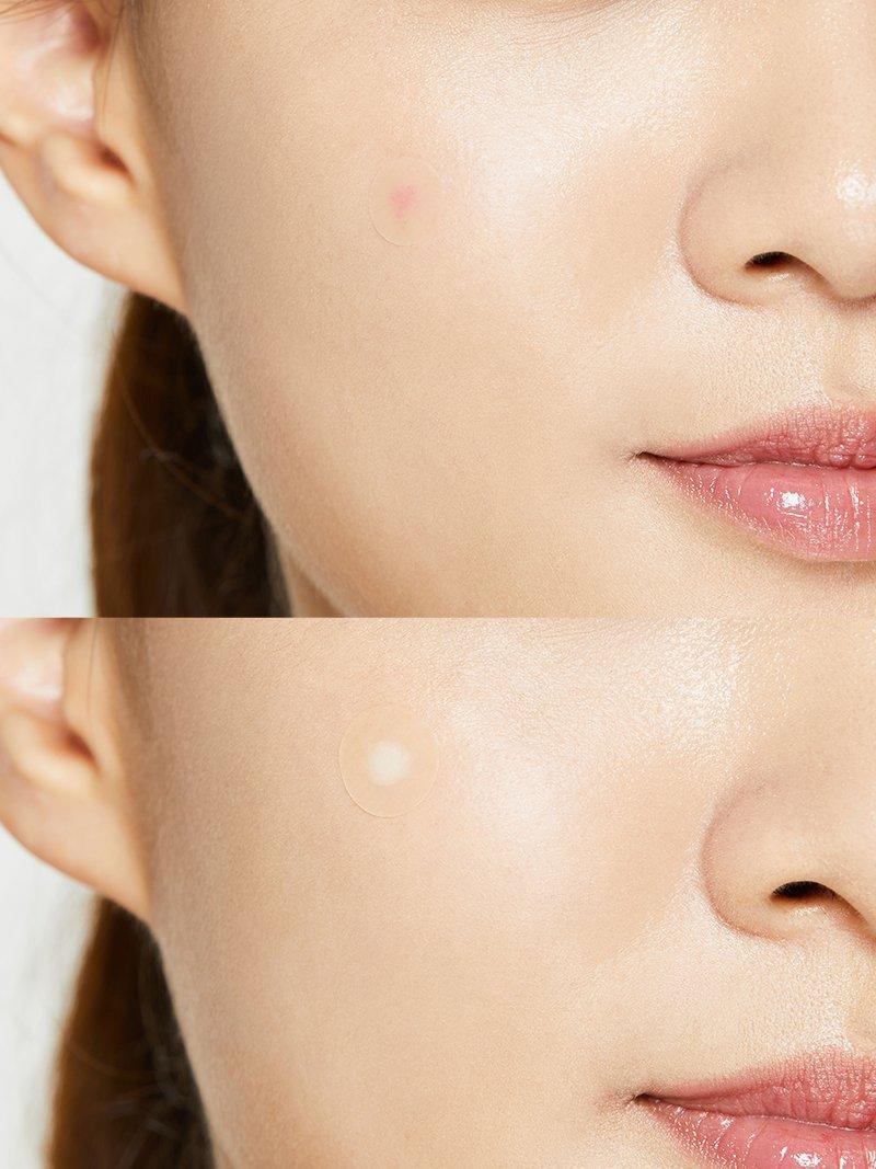 COSRX Acne Pimple Master Patch 24 patchs